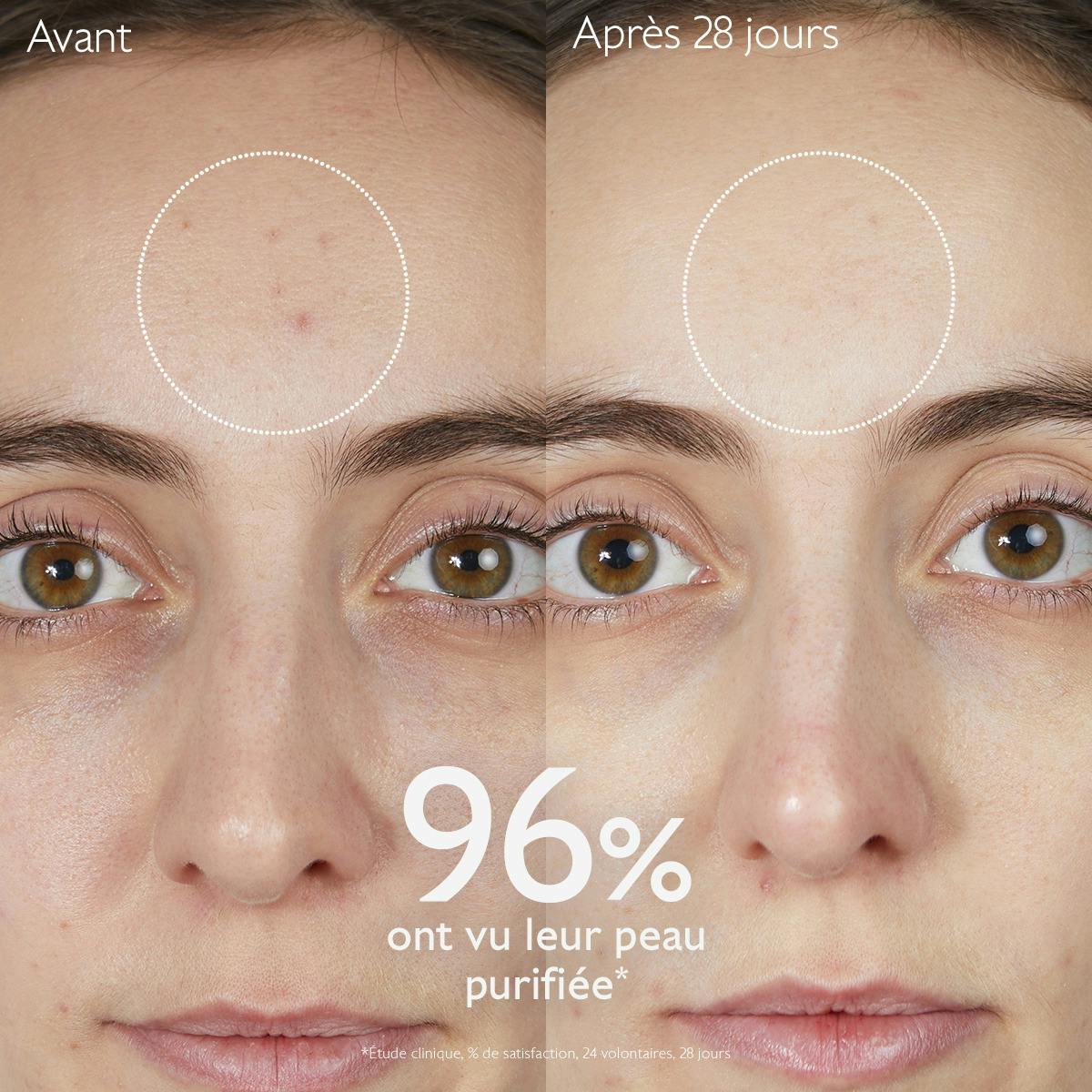 Gelée Nettoyante à l'Acide Salicylique Purifiante - 385mL