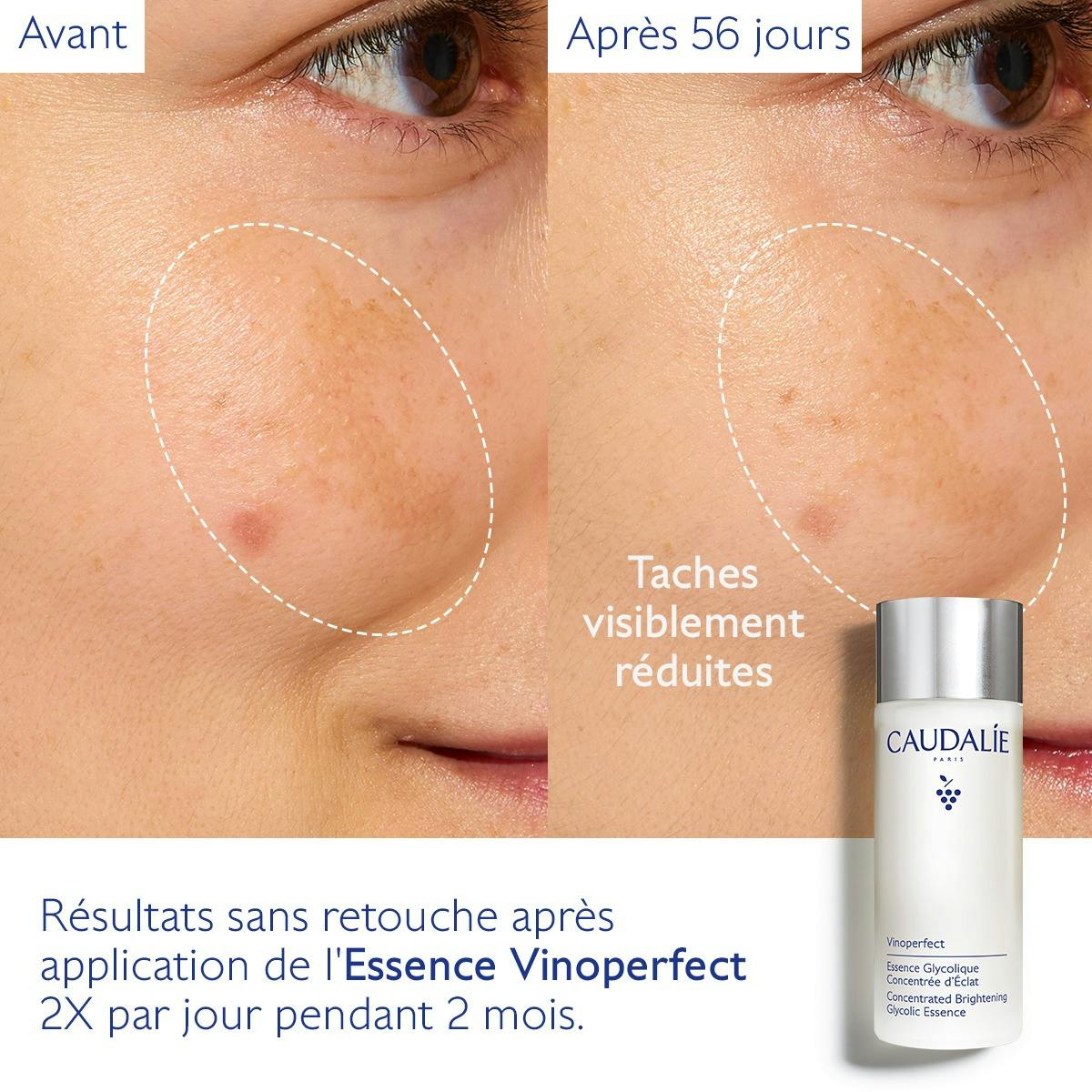 Essence à l'Acide Glycolique Concentrée d'Éclat