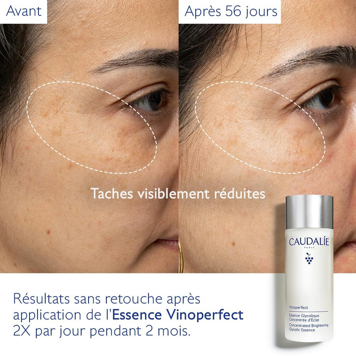 Essence à l'Acide Glycolique Concentrée d'Éclat