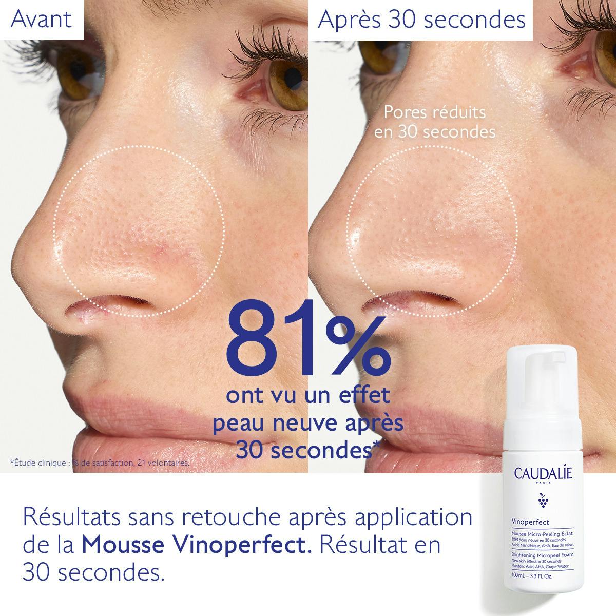 Mousse Micro-Peeling Éclat à l'Acide Mandélique (AHA) - 50mL