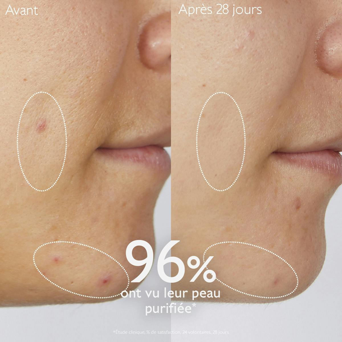 Gelée Nettoyante à l'Acide Salicylique Purifiante - 385mL