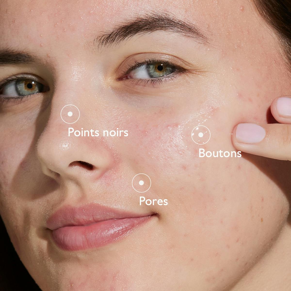 Sérum à l'Acide Salicylique Anti-imperfections