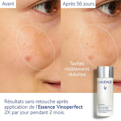 Essence à l'Acide Glycolique Concentrée d'Éclat