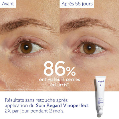 Soin Éclaircissant Regard Anti-Cernes à la Caféine et Niacinamide
